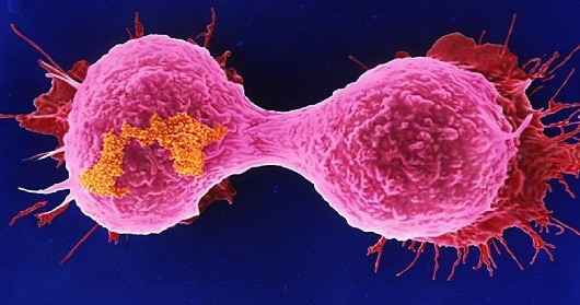 breast-cancer-cells