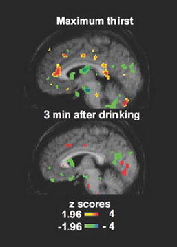 thirst-regulation-brain-scan_red